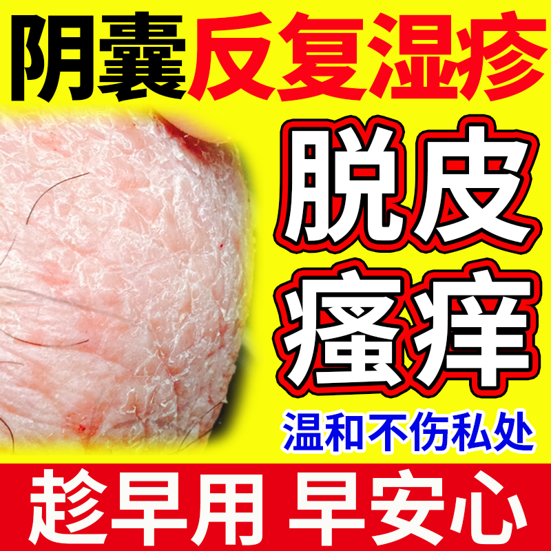 男性阴囊湿疹瘙痒男人脱皮干燥潮睾丸湿蛋蛋皮痒私处出汗药止痒OZ