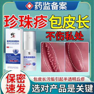 男士龟头炎珍珠疹专用搭药房同款珍珠珍珠状丘疹去除冠状沟喷剂OZ