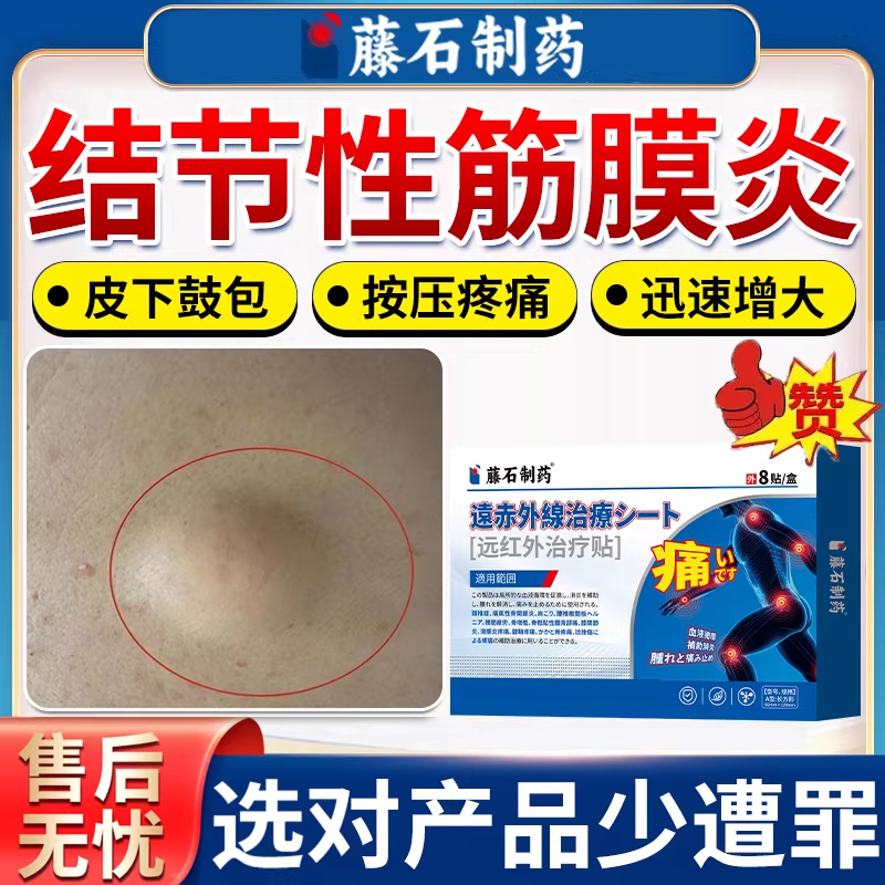 结节性筋膜炎特手部胳膊皮下鼓包肿块效肌肉疼痛散结可搭膏药贴BS