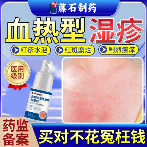 【药监备案】血热型湿疹舒缓喷雾