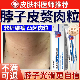皮赘膏去除神器软组织纤维瘤脖子上脂肪粒腋下小肉粒药房同款膏BS