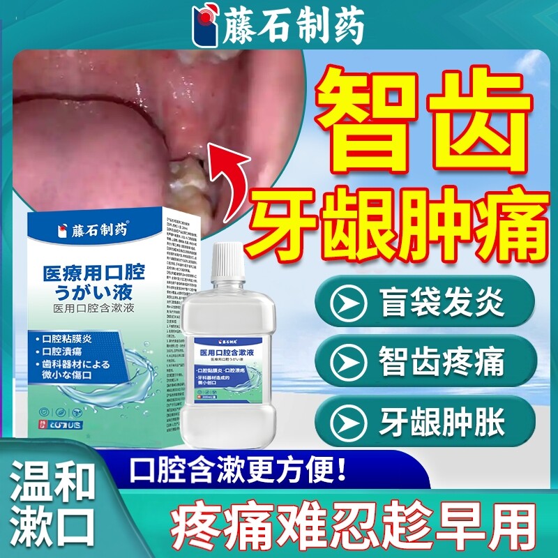 智齿牙龈肿痛消炎冠周炎藤石制药发炎漱口水牙膏盲袋智齿窝清洗OZ