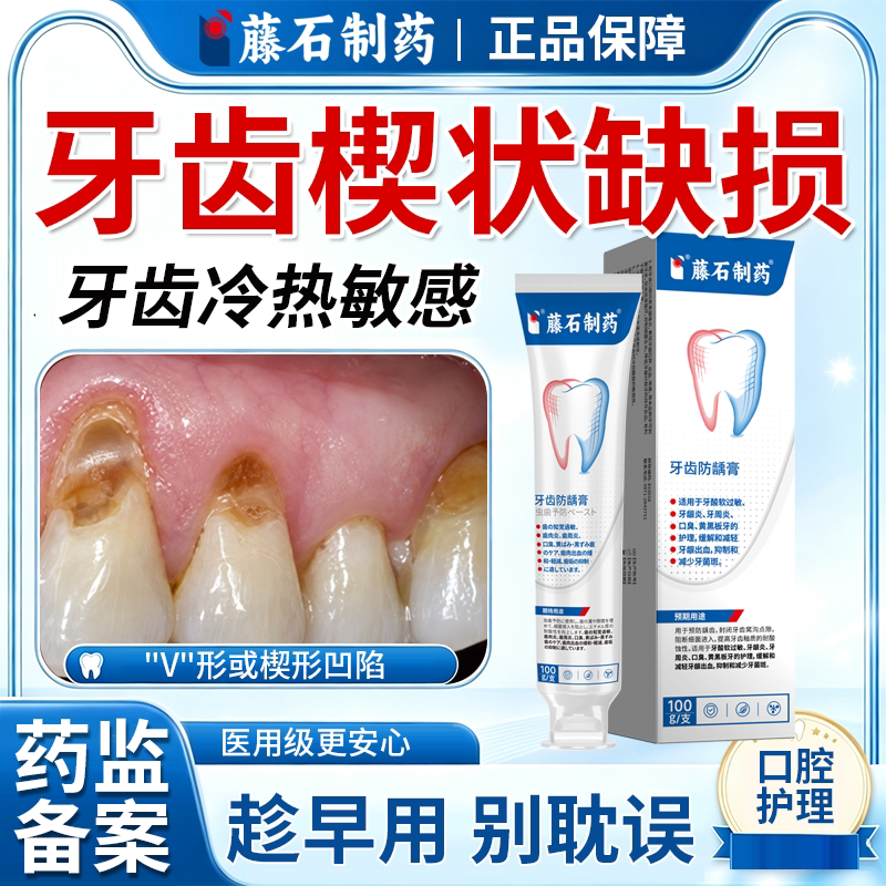 牙齿楔状缺损修补牙釉质修复非牙膏抗敏感酸痛牙根外露牙龈萎缩QF