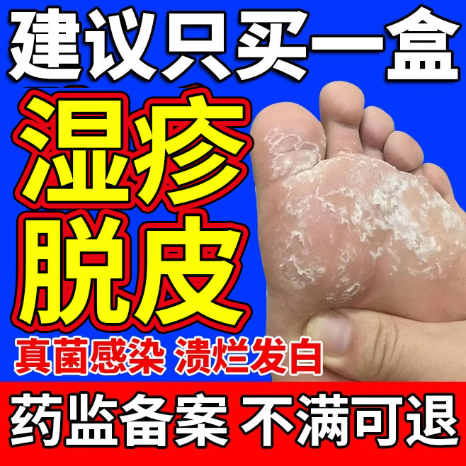 足癣脚癣瘙痒脱皮【药监备案】