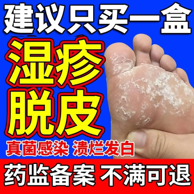 足癣脚癣瘙痒脱皮【药监备案】