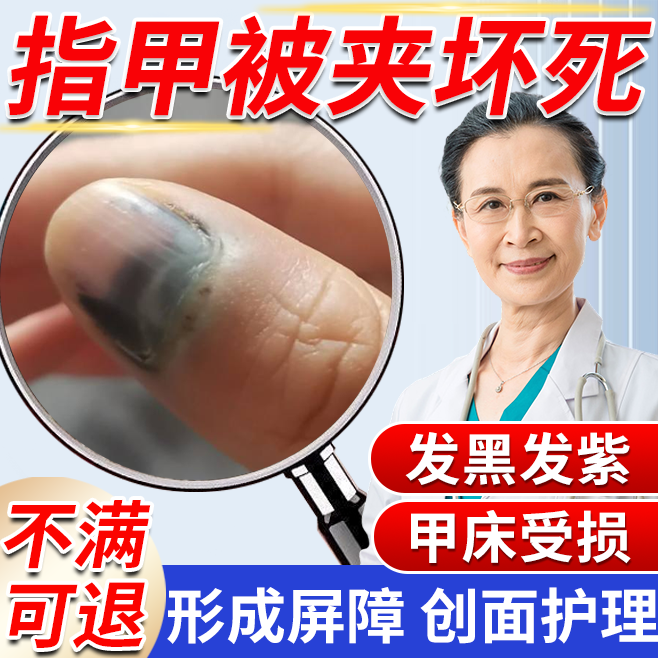 指甲被夹甲下淤血黑紫止痛修复液