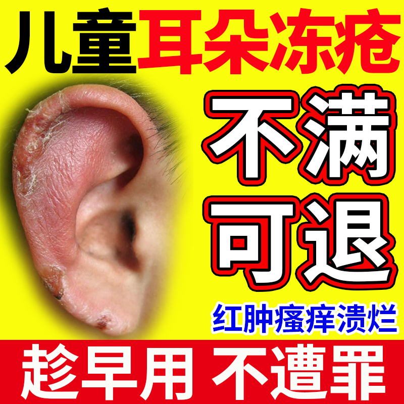 儿童耳朵冻疮】医用皮肤护理修护