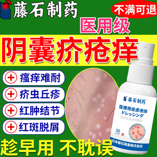 阴囊疥疮结节特疥虫效皮肤止瘙痒药房同款膏除疥螨喷雾硫磺软膏MA