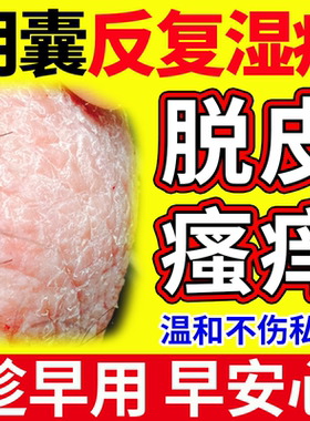 阴囊湿疹瘙痒脱皮干燥潮睾丸湿起皮干裂蛋蛋皮痒男人士红肿裂口OZ