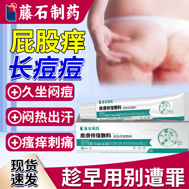 屁股上长痘痘痒起热疙瘩久坐板疮痤疮膏癣真菌感染湿疹藤石制药OZ