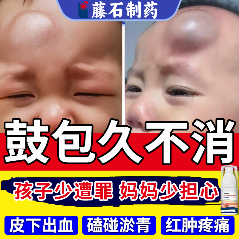 消肿止痛膏促进局部血液循环