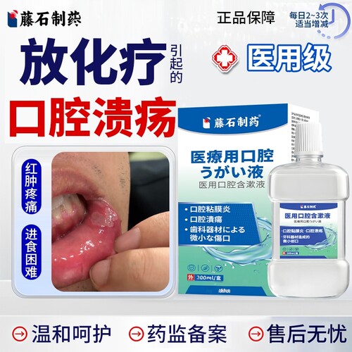 【医用级】放化疗后引起口腔溃疡