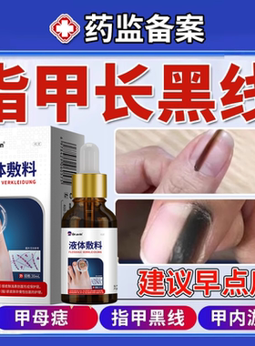 甲母痣指甲黑线变黑灰指甲真菌感染手指脚趾指甲淤血黑色竖纹DZ