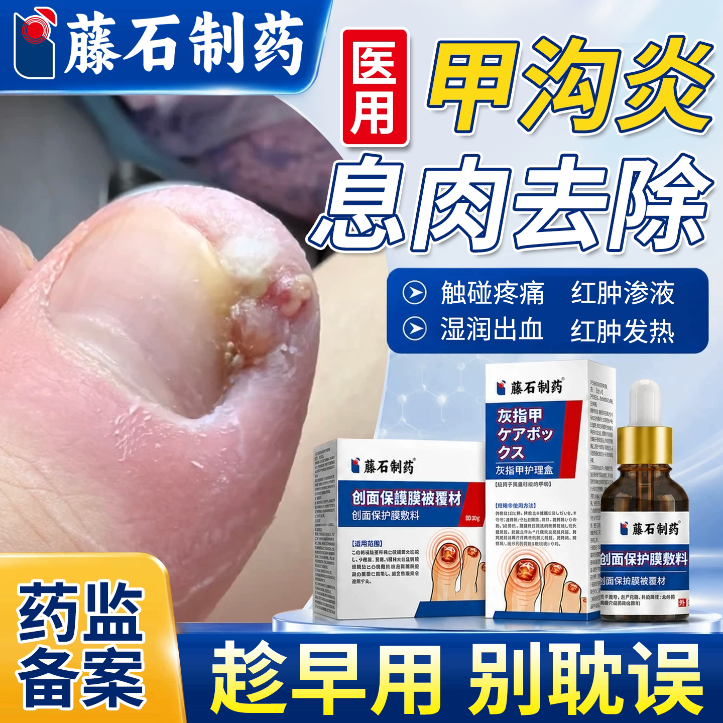 【医用级】甲沟炎息肉去除