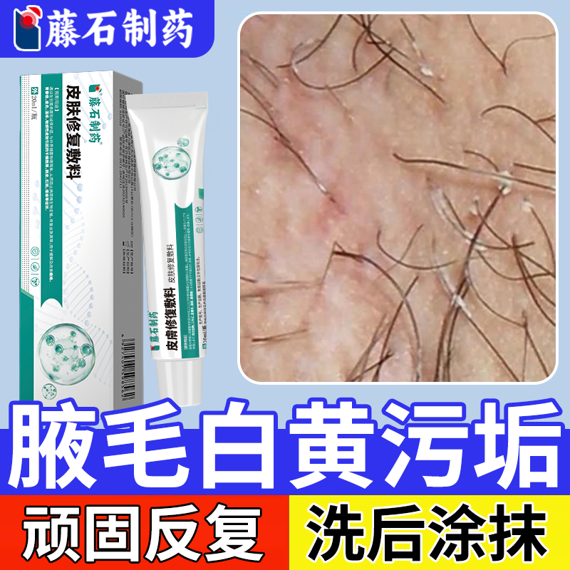 腋毛癣白色附着物腋下藓清洁清洗剂腋窝去异味真菌感染包浆瘙痒OZ