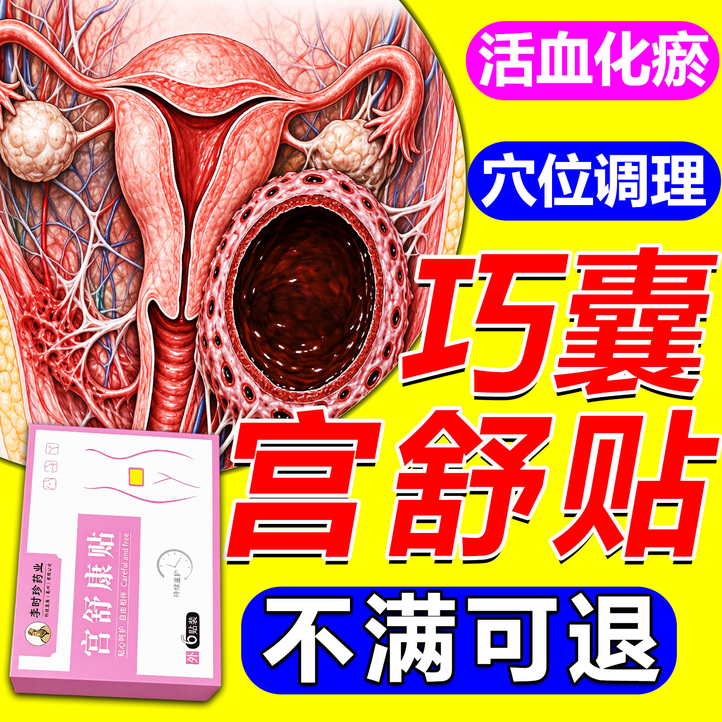 巧克力卵巢囊肿调理中药贴