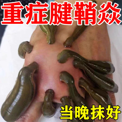 【当晚冶好】腱鞘专用焱型膏药手腕大拇指关节疼痛手指鼓包消除膏