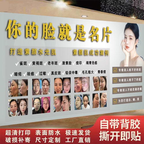 美容院皮肤管理宣传海报斑敏痘干炎皱祛斑祛痘墙壁宣传图背景挂画