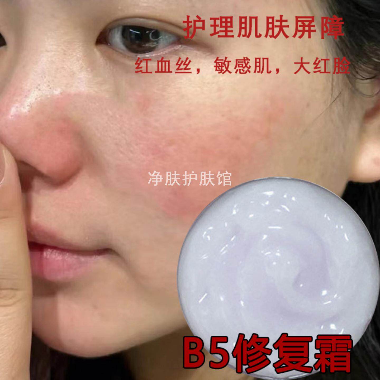 b5修复霜修护霜去红血丝舒缓激素