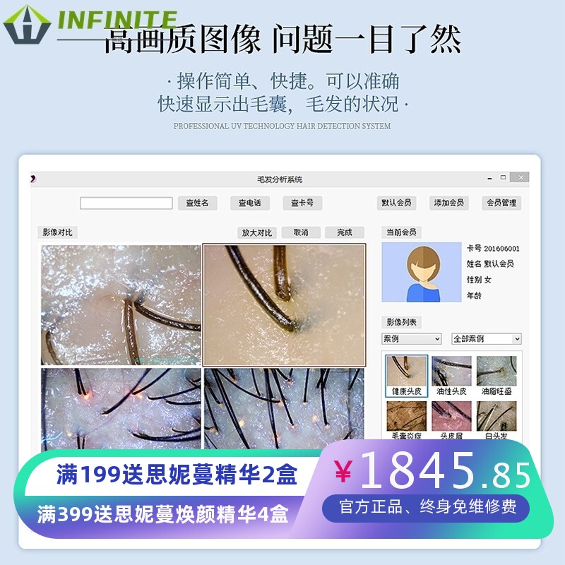 电脑型毛发检测仪高清头皮头发分析仪智能毛囊分析仪器头发检测仪