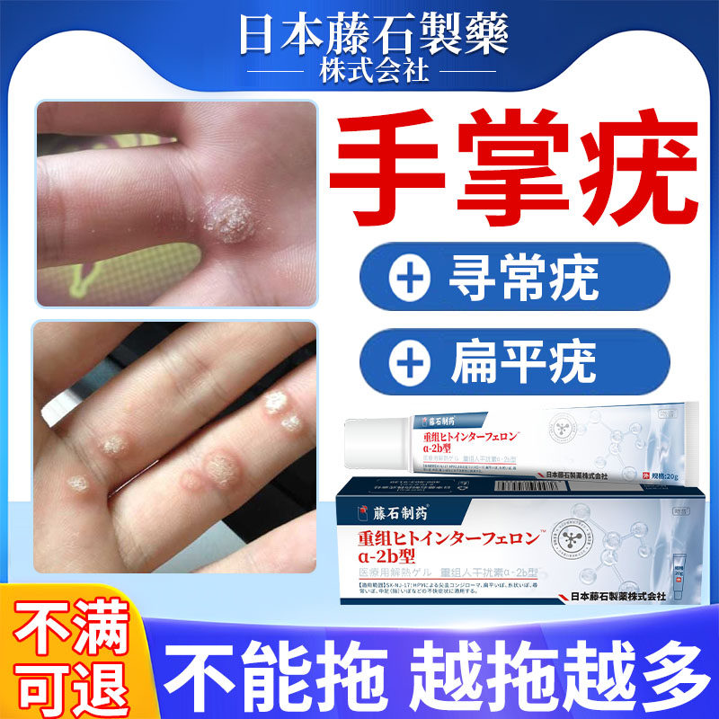 手上长疣瘊子猴子肉粒祛寻常疣刺猴肉刺小肉疙瘩药房同款膏去除yr