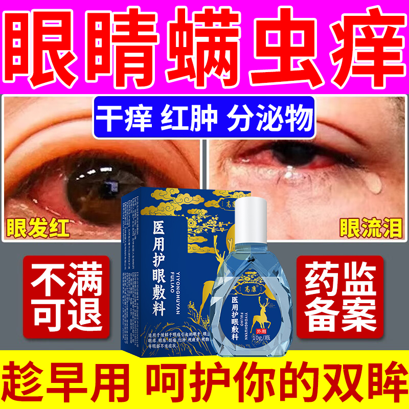 【眼睛螨虫痒】眼干眼痒分泌物多