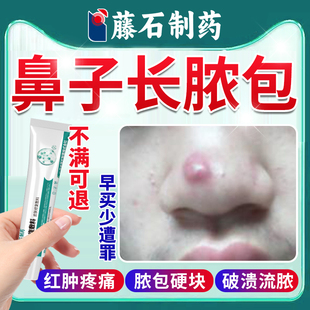 鼻子上长脓包红肿痘痘去红鼻头鼻尖红肿火疖子痤疮毛囊炎肉疙瘩DZ