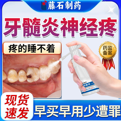 【速发】牙髓炎牙神经痛止疼喷剂
