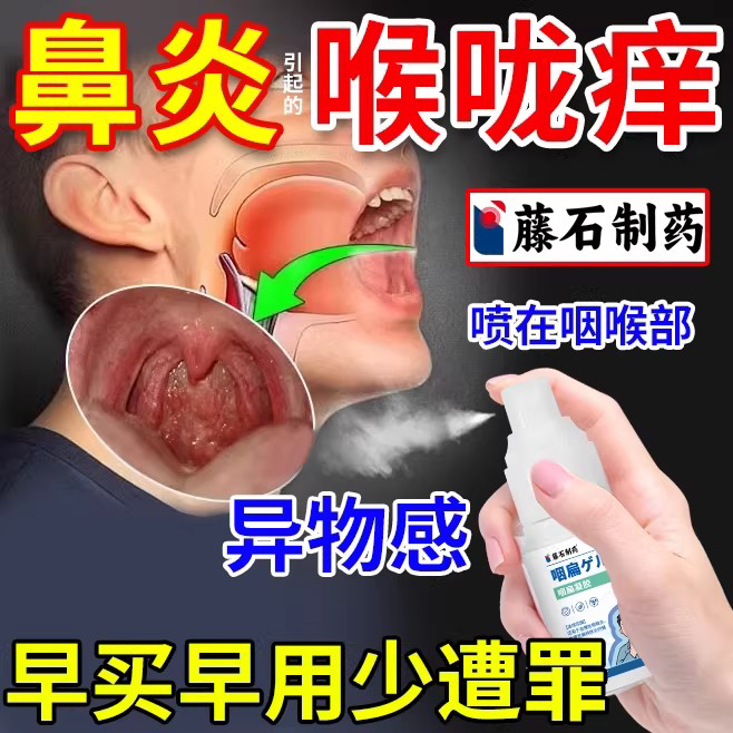 过敏性鼻炎喉咙上颚痒眼睛痒嗓子尘螨儿童贴专用喷雾止痒喷雾剂DZ