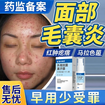 【售后无忧】面部毛囊炎脸上痤疮