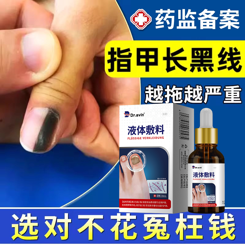 【指甲长黑线】甲母痣手指脚趾