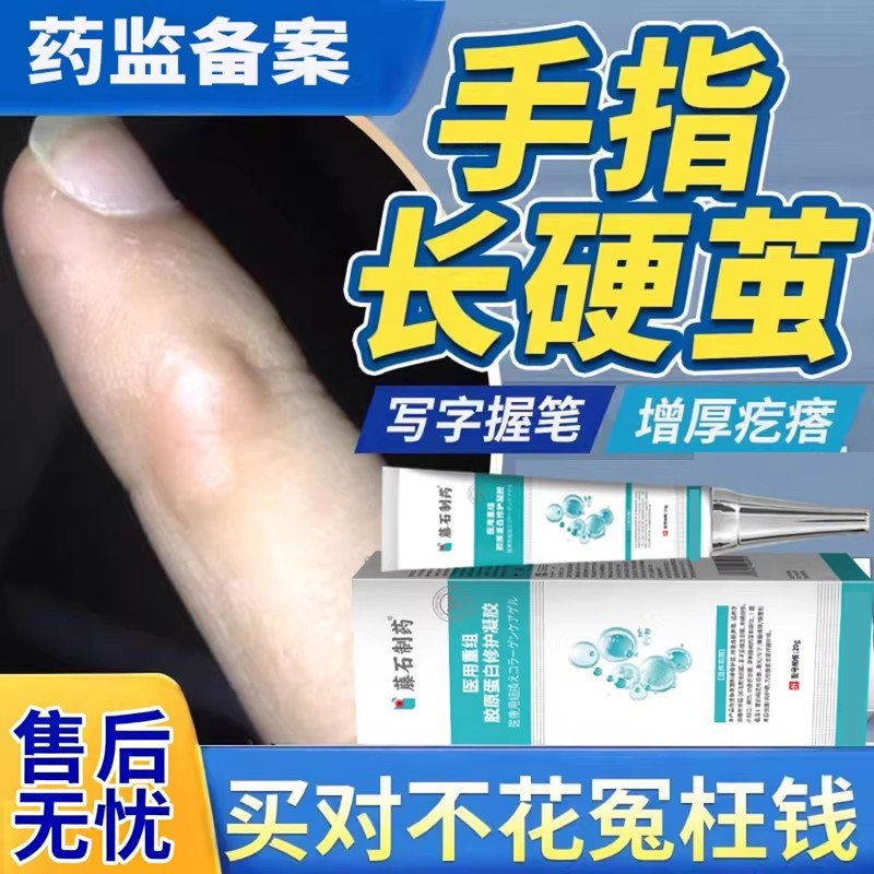 手茧去除手指硬皮软化剂去手指头上老茧硬疙瘩死皮硬块学生神器EM