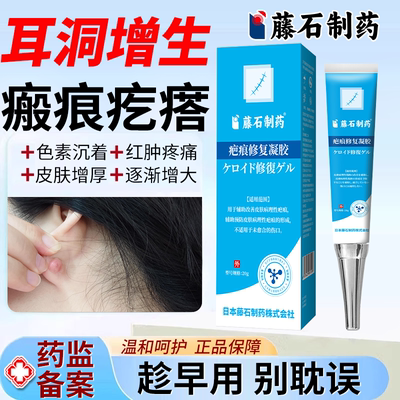 【藤石制药】耳洞增生瘢痕疙瘩用