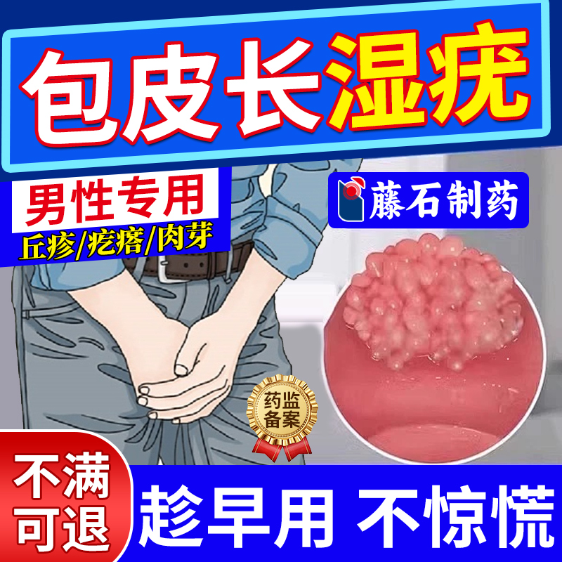 【现货速发】私处包皮长湿疣买它
