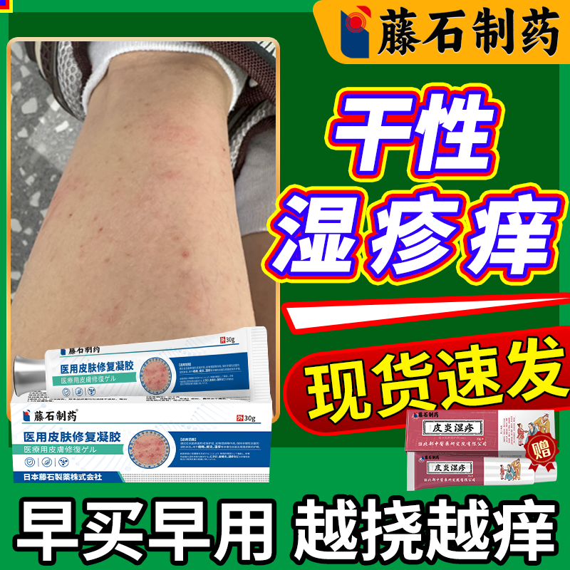 藤石制药】干性湿疹皮肤修复凝胶