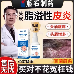 儿童脂溢性皮炎毛囊炎头皮屑消真菌感染杀菌头癣头部炎喷剂喷雾DZ