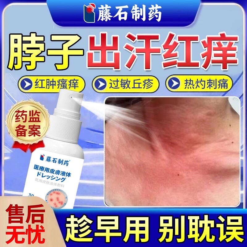 夏天脖子出汗红痒皮肤过敏湿疹止痒膏喷剂搭成人痱子粉防淹脖子EM