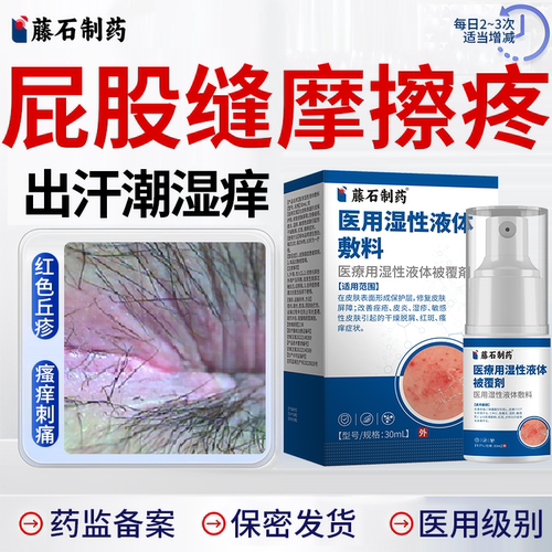 【医用级】屁股缝出汗摩擦疼喷剂