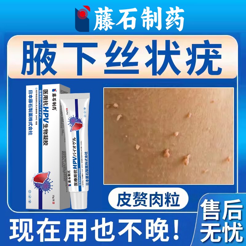 藤石制薬腋下脖子上长小肉粒疙瘩丝状疣专用膏腋下去除神器凝胶DZ