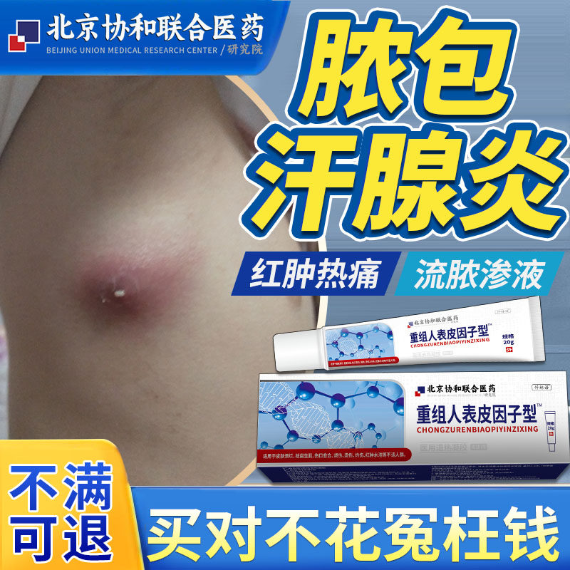 汗腺炎腋下脓包型痘痘毛囊炎咯吱窝长硬疙瘩化脓性腋窝红肿热痛yr