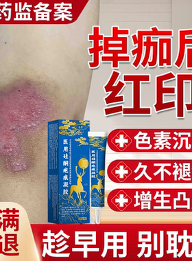掉痂后去红印黑色素沉淀修复膏退红淡印面部擦伤摔伤疤痕除疤膏JW
