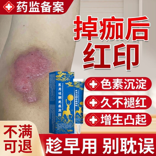 掉痂后去红印黑色素沉淀修复膏退红淡印面部擦伤摔伤疤痕除疤膏JW