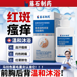 藤石制药毛囊炎二硫化硒沐浴露洗剂前胸后背长痘痘祛痘硫磺肤清OZ