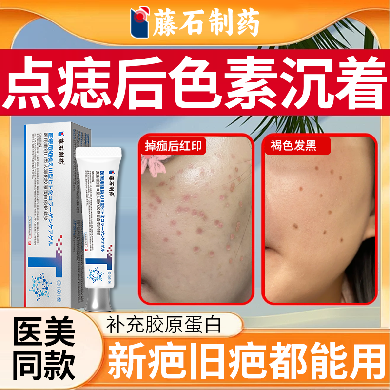 祛点痣后红印黑印修复膏