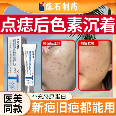 祛点痣后红印黑印修复膏