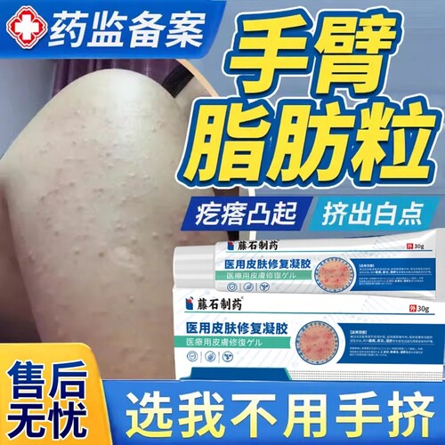 【藤石制药】专研胳膊脂肪粒疙瘩