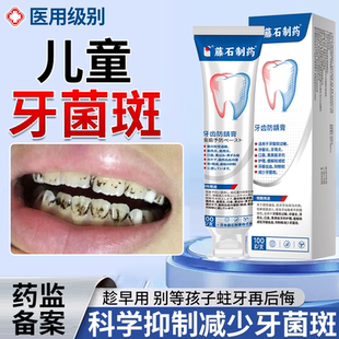 儿童小孩牙黑斑牙齿黑色素沉淀牙菌斑黑牙去除可搭祛除牙膏神器JW