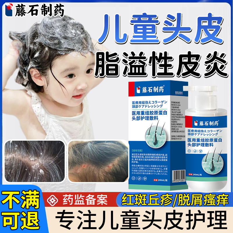 儿童头皮脂溢性皮炎毛囊炎洗发水去屑止痒抑菌真菌感染头癣喷剂EM,医疗器械,保健理疗,淘宝优惠券,粉丝福利购,淘宝优惠卷