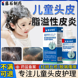 儿童头皮脂溢性皮炎毛囊炎洗发水去屑止痒抑菌真菌感染头癣喷剂EM