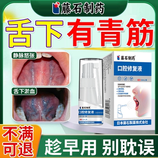 舌头下有青筋又黑又粗淤血长青黑紫泉口喷溶栓舌立康舌炎喷雾剂EM